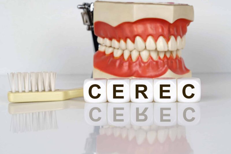 cerec same day crowns mecosta