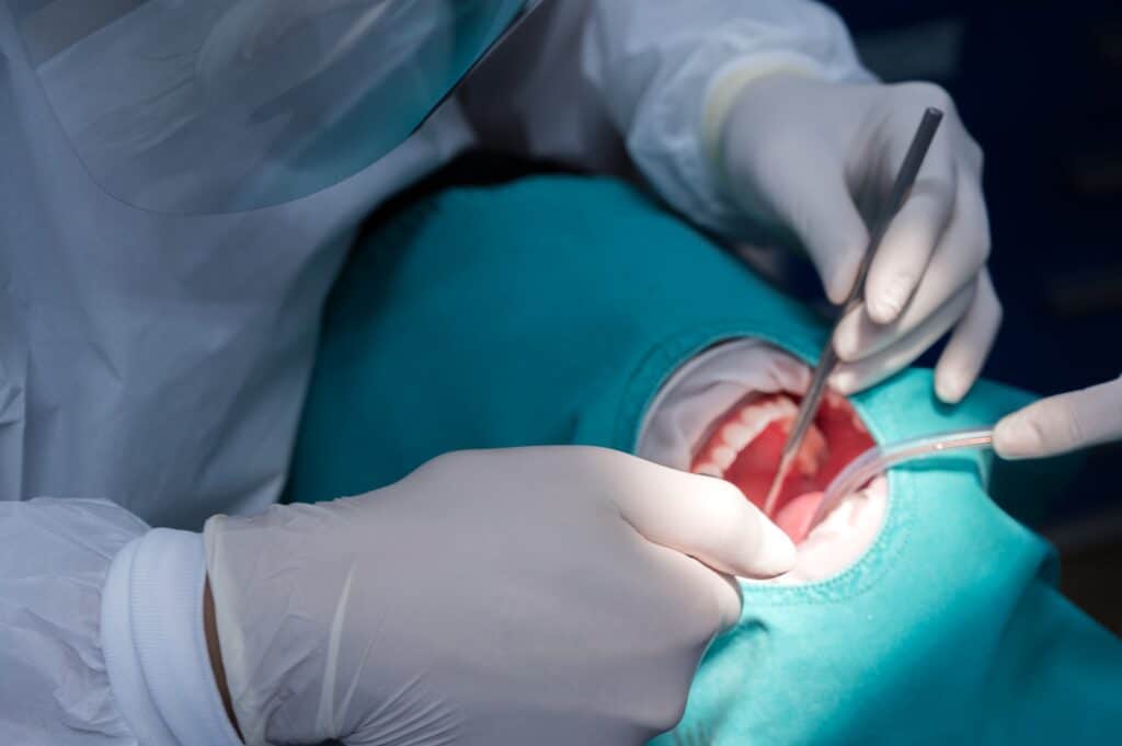 Oral Surgery mecosta