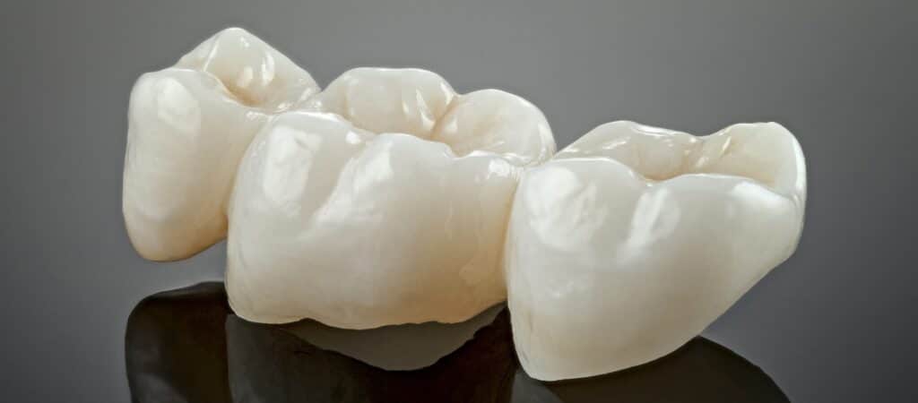 same day crowns near me
