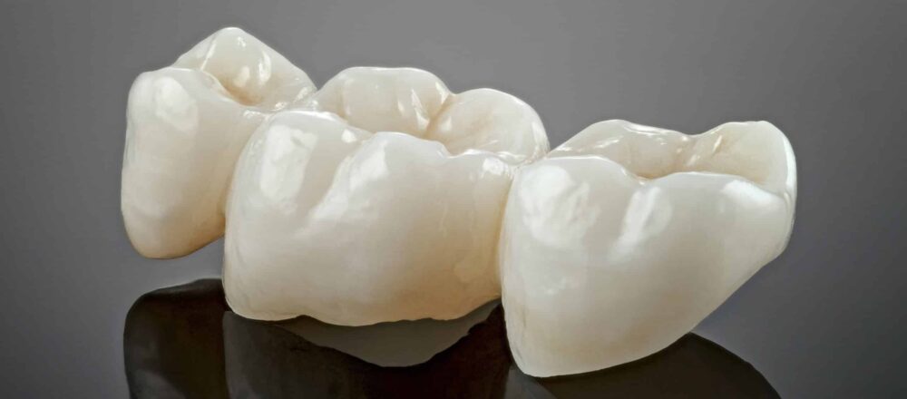 same day crowns near me